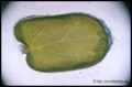 cotyledon in formation before the accumulation of the reserves seen at Judas-tree (Cercis siliquastrum)