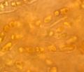 The cyanobacterium Hyella caespitosa with fungal hyphae in the lichen Pyrenocollema halodytes